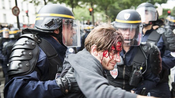 Появились фото с протестов во Франции, где ранили и задержали десятки людей