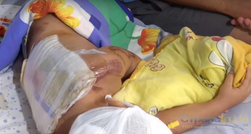 Страшное ДТП с участием ребенка: зажатым между асфальтом и двигателем мальчика протянуло 8 метров. Детали шокируют
