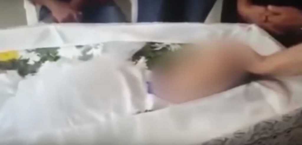 «Лежала в гробу и тут…»: Родители остановили похороны, когда их дочь пошевелила пальцем