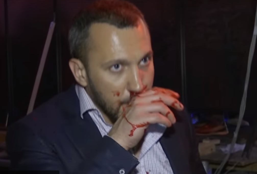 Разбитый нос и отряд скорой помощи: В прямом эфире украинского телеканала депутаты устроили настоящий мордобой