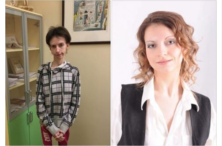 «Женщина довела себя до веса 23 кг, а все из-за …»: Пользователей Сети поразила история украинки