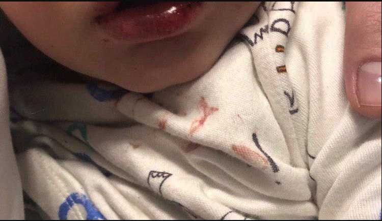 Избила до крови и уснула: подвыпившая няня жестоко издевалась над ребенком