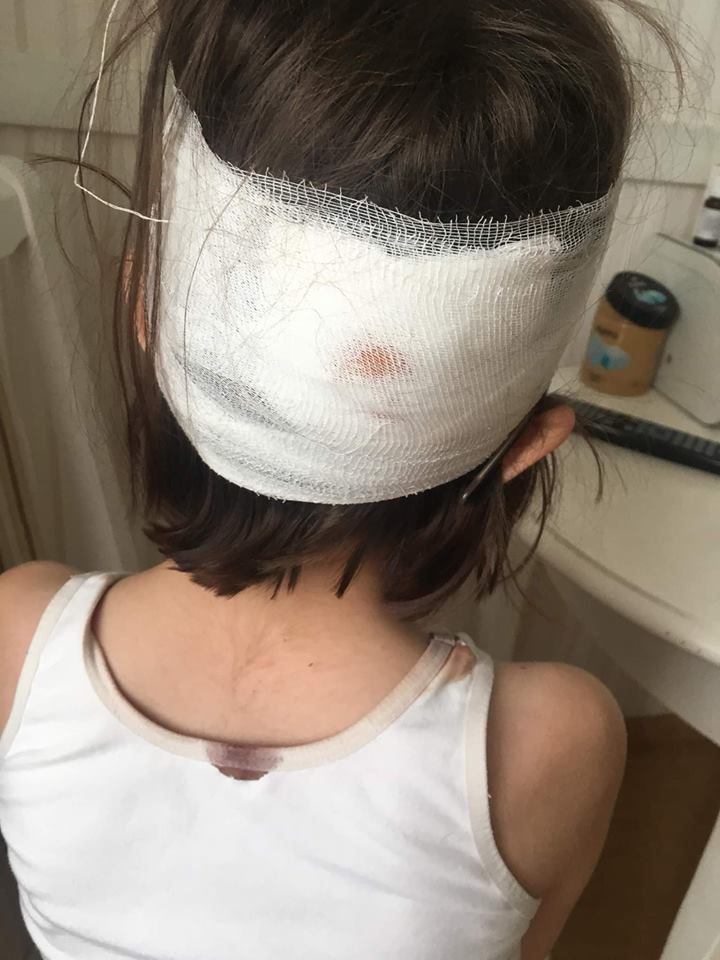 » Дочь лежала в крови »: из-за травмы ребенка в одной из киевских школ разгорелся громкий скандал