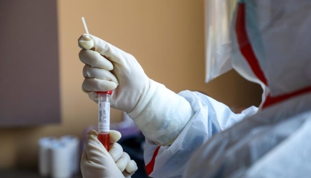 За сутки 62 новых случаев! Ситуация с коронавирусом в Украине ухудшается. 11 летальных