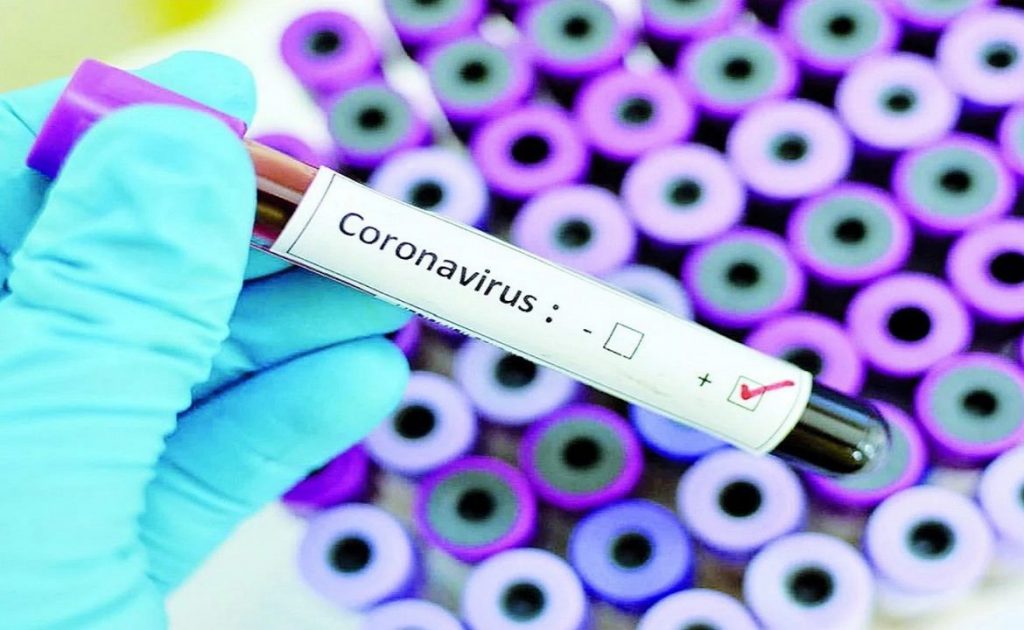 «За сутки увеличилось количество больных и подозрений»: Стало известно, какова ситуация с коронавирусом на Львовщине