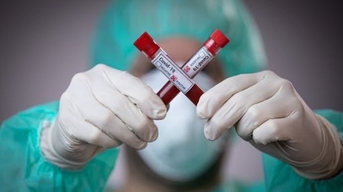В общем 708 летальных! В Украине снова возросло количество больных коронавирусом. Оперативная информация