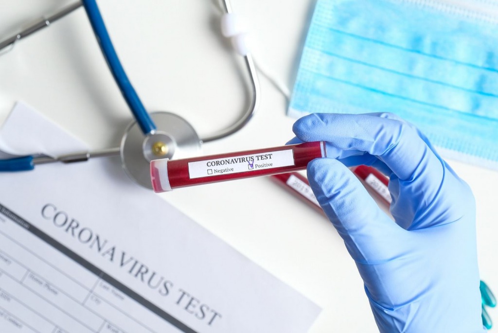 «Мы не прошли испытание»: На Винниччине вторая волна массового заражения коронавирусом