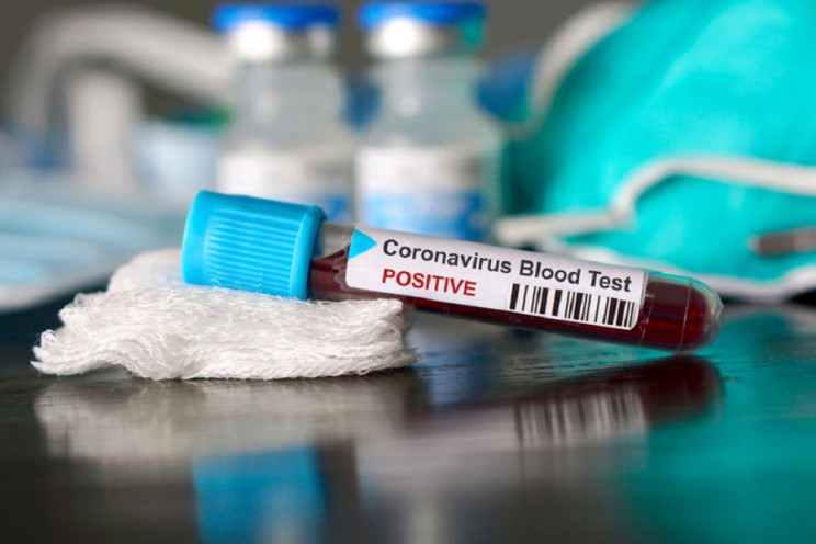 Хорошая новость! Количество больных коронавирусом на Львовщине. Тенденция на уменьшение