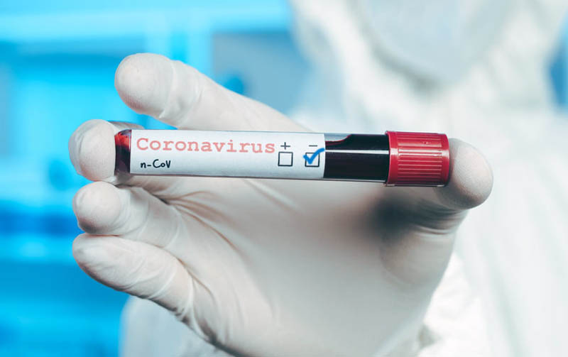 Больше всего с начала карантина! В Украине больше 30 000 случаев коронавируса. За последние сутки печальный антирекорд!