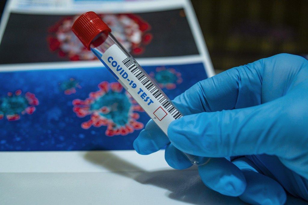 Хорошая новость! Ситуация с коронавирусом в Украине за минувшие сутки — новых случаев меньше