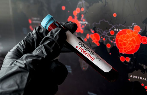 Более 100 тысяч инфицированных. Статистика МЗ по коронавирусу на 21 августа: лидер Черновицкая область
